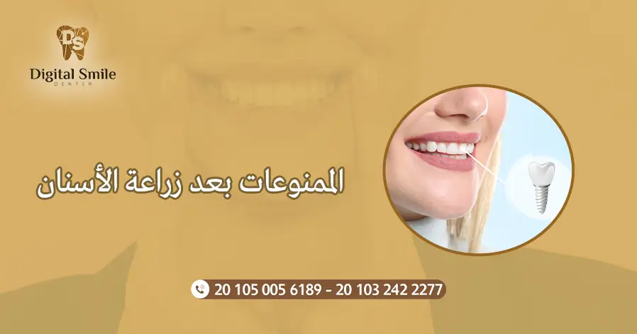 الممنوعات بعد زراعة الأسنان