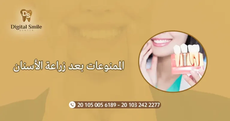 الممنوعات بعد زراعة الأسنان