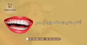 دليلك لاختيار أفضل دكتور ابتسامة هوليود في مصر: نصائح وخبرات