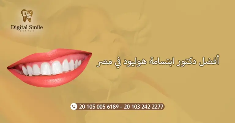 دليلك لاختيار أفضل دكتور ابتسامة هوليود في مصر: نصائح وخبرات