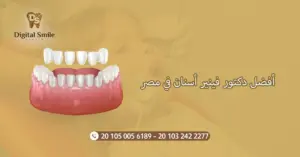 أفضل دكتور فينير أسنان في مصر: تجارب المرضى| ديجتال سمايل