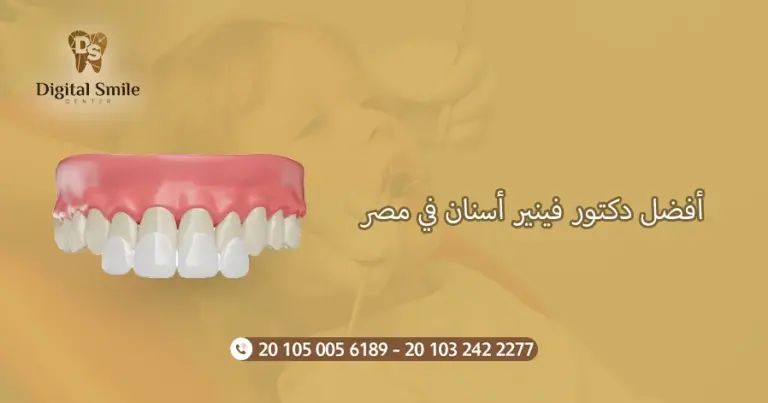 أفضل دكتور فينير أسنان في مصر: تجارب المرضى| ديجتال سمايل