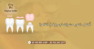 أفضل دكتور حشوات تجميلية في القاهرة: تجارب وآراء المرضى