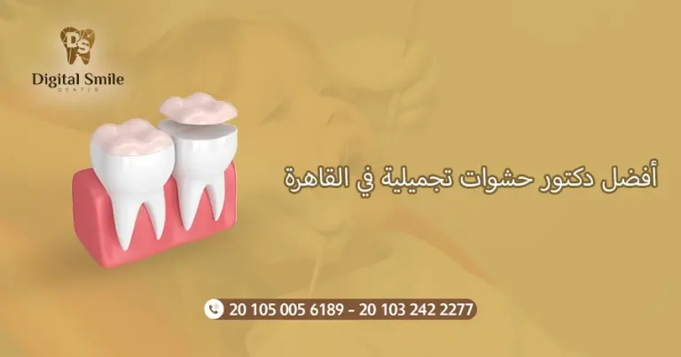 أفضل دكتور حشوات تجميلية في القاهرة: تجارب وآراء المرضى