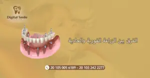 الفرق بين الزراعة الفورية والعادية : دليل شامل للمرضي