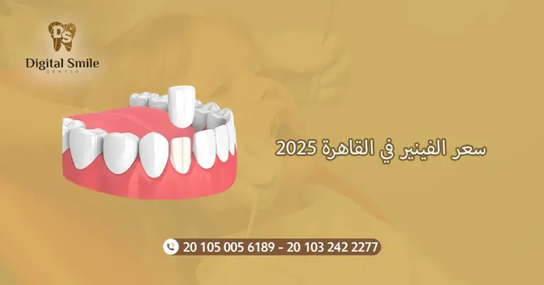 سعر الفينير في القاهرة 2025: مقارنة بين الخيارات والمزايا