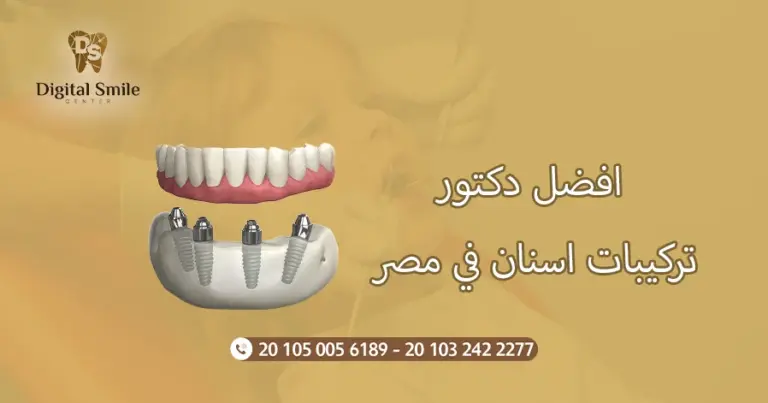 افضل دكتور تركيبات اسنان في مصر: خدمات وأسعار مميزة