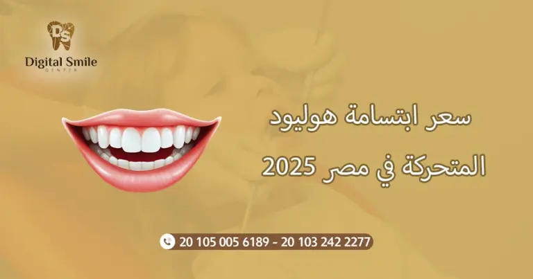 دليل شامل حول سعر ابتسامة هوليود المتحركة في مصر 2025