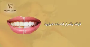 ابتسامة هوليود: الفوائد والمخاطر التي يجب أن تكون على دراية بها