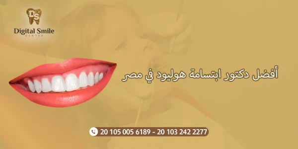 دليلك لاختيار أفضل دكتور ابتسامة هوليود في مصر: نصائح وخبرات