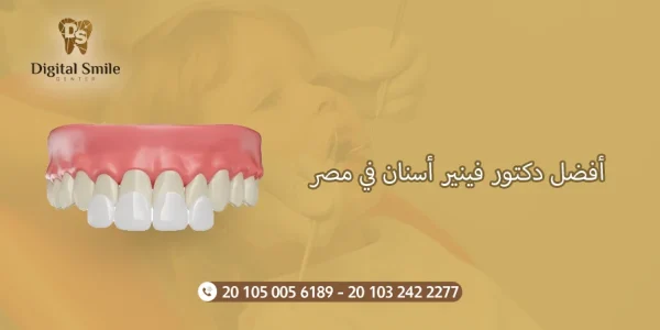 أفضل دكتور فينير أسنان في مصر: تجارب المرضى| ديجتال سمايل