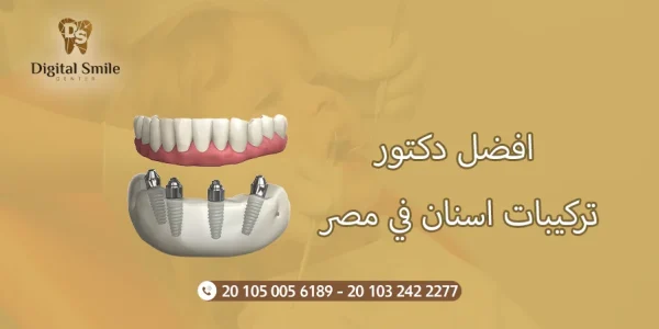 افضل دكتور تركيبات اسنان في مصر: خدمات وأسعار مميزة