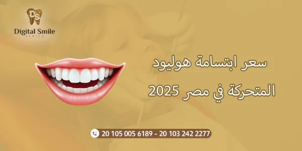 دليل شامل حول سعر ابتسامة هوليود المتحركة في مصر 2025